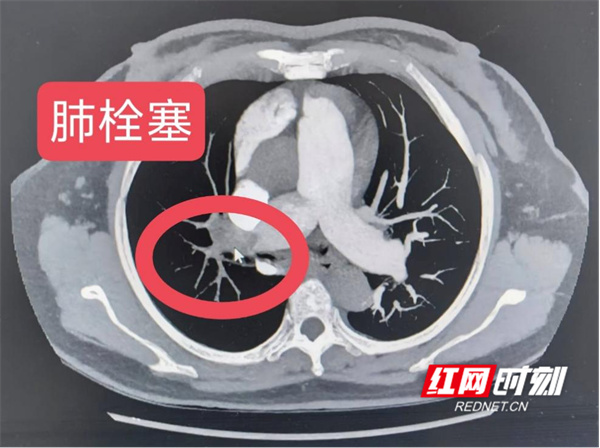 图片1.jpg 图片1.jpg